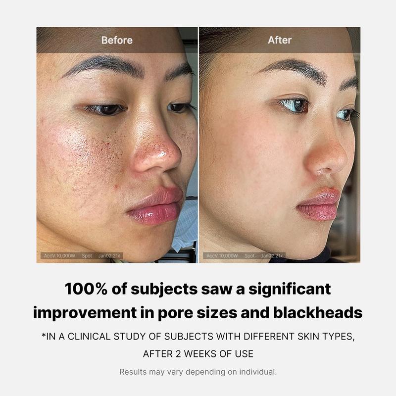 Mix & Match Toner Pad Setㅣ Pore, Use After Spot, Brightening Care for Clear & Glass Glow SkinㅣTikTok Viral Toner Pads