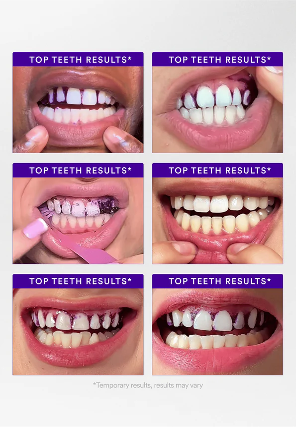 V34 Whitening Strips