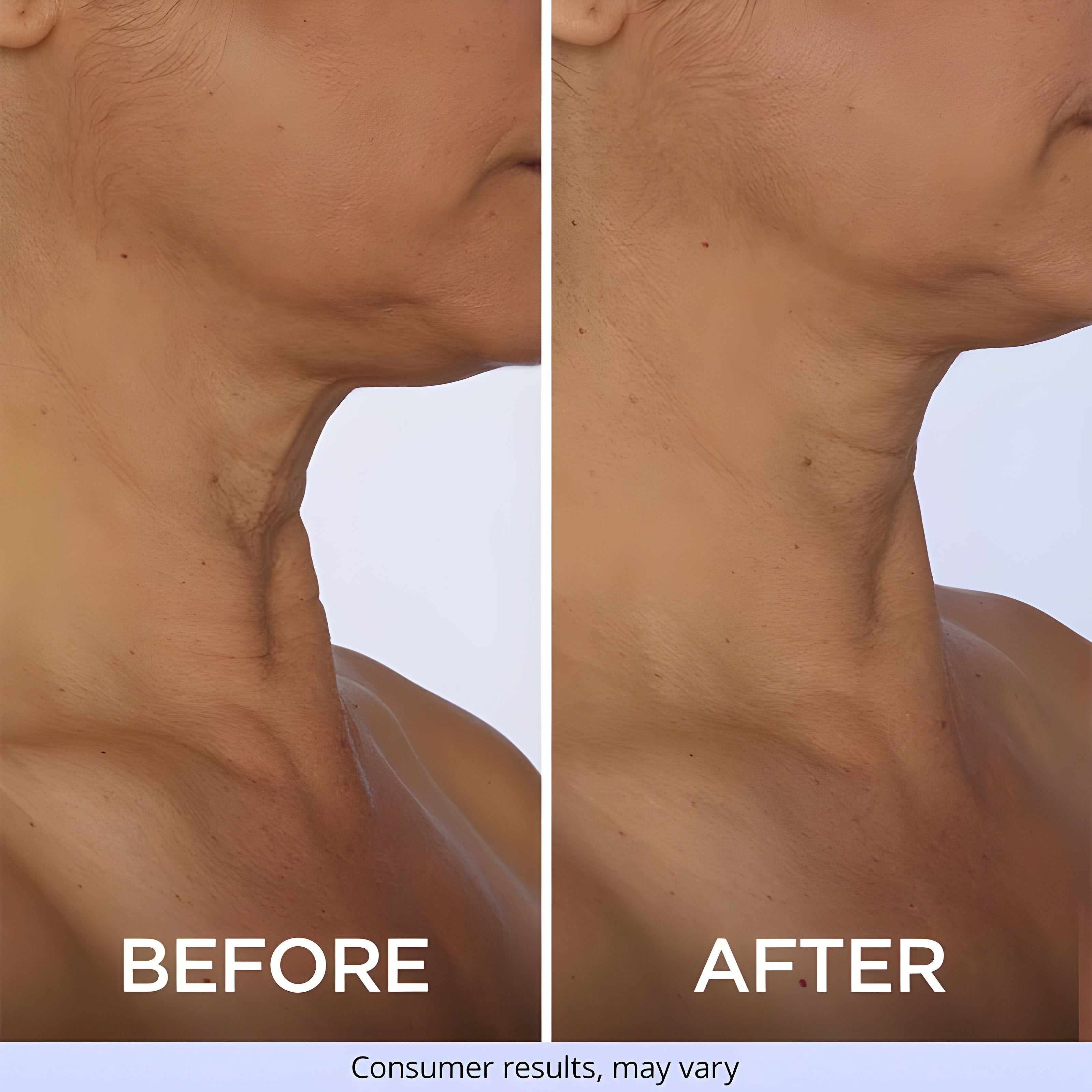 Viral GOPURE Neck Cream Tighten & Lift Firming Cream for Crepey Skin