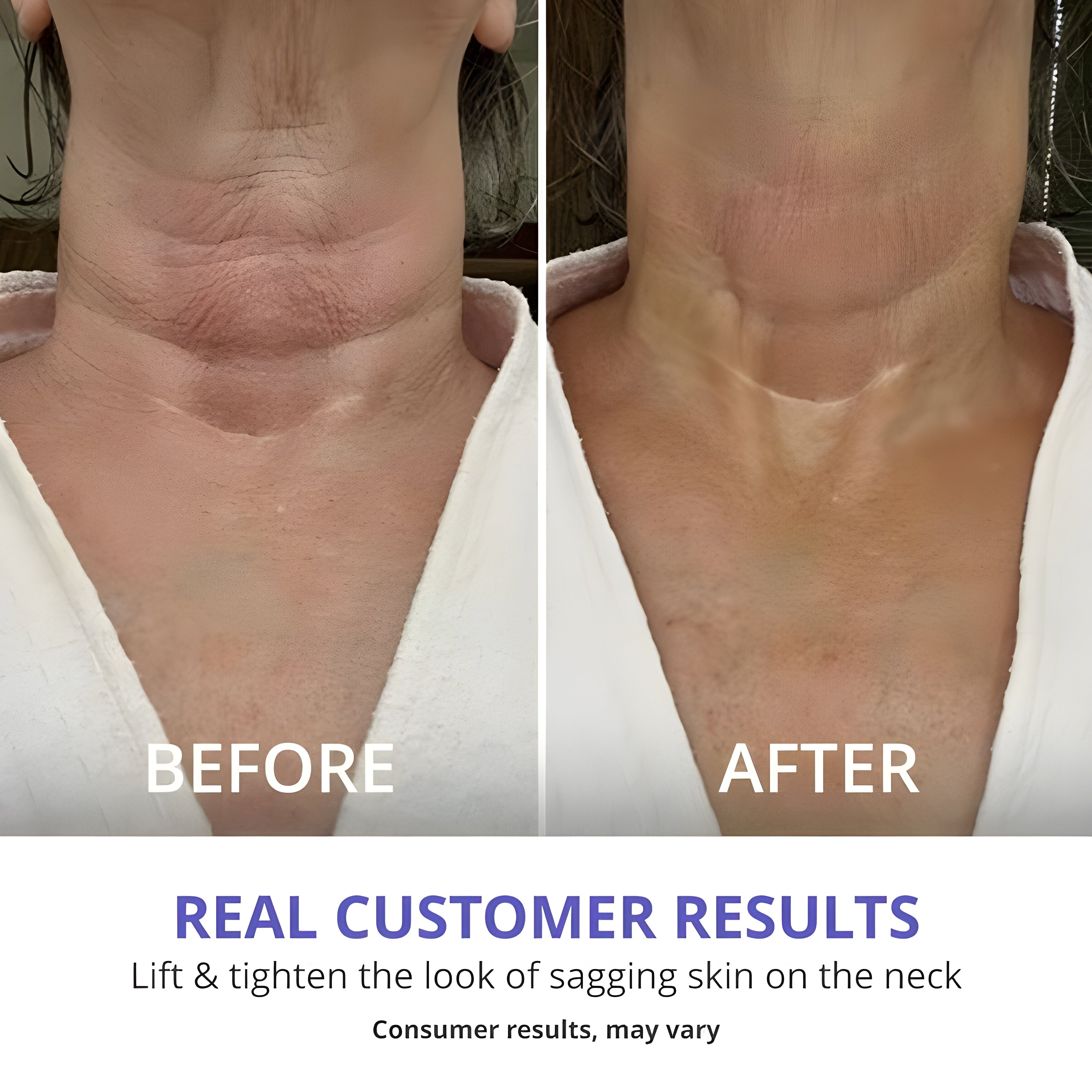Viral GOPURE Neck Cream Tighten & Lift Firming Cream for Crepey Skin