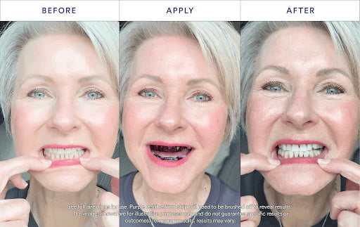 V34 Whitening Strips
